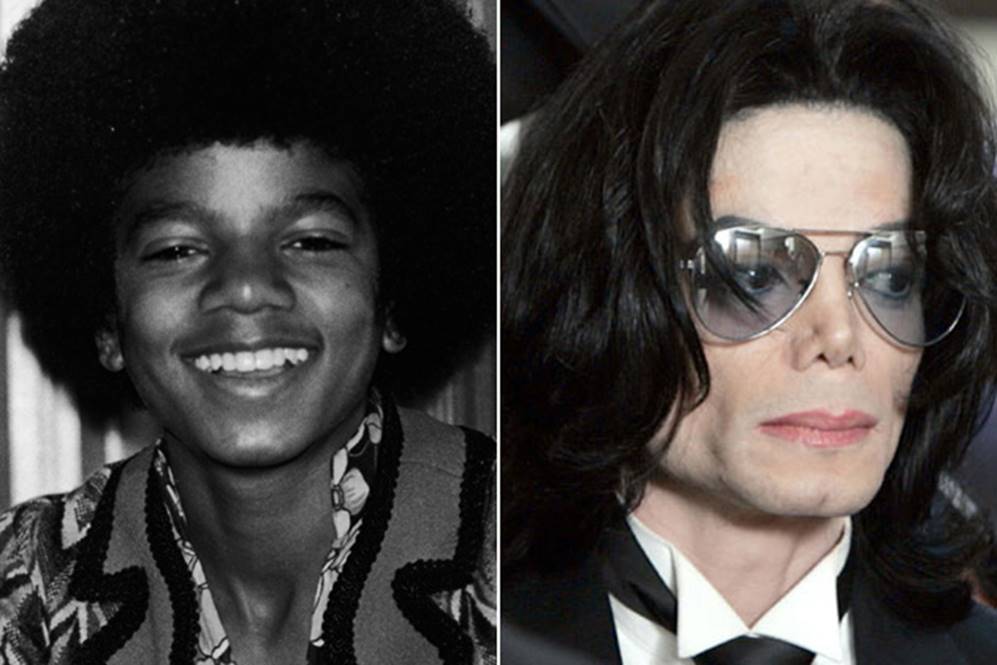 The Michael Jackson Before and After Plastic Surgery